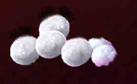 Moth balls, made of napthalene, placed in drawers and cupboards with clothes to deter the clothes moth which would eat small holes into wool.